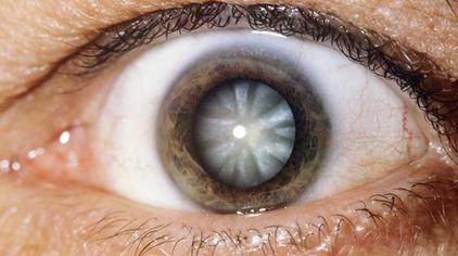 害眼病 - 西瓜视频